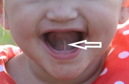 tounge