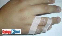 knuckle_injuries